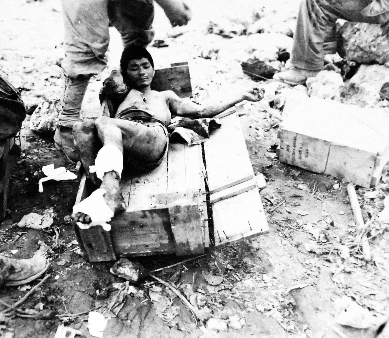 127-GW-666-124049:  Okinawa Campaign, April-June 1945.   Captured Japanese soldier getting medical aid at our station on Okinawa.  His wounds even had maggots crawling around in the flesh.   Photographed by Gudas, June 10, 1945.  Official U.S. Marine Photograph, now in the collection of the National Archives.  (2014/7/23). 